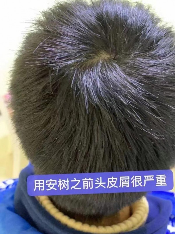 安树健发滋养氨基酸洗护系列，秀发问题一网打尽！