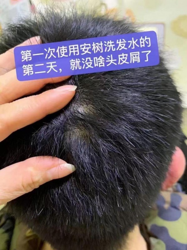 安树健发滋养氨基酸洗护系列，秀发问题一网打尽！