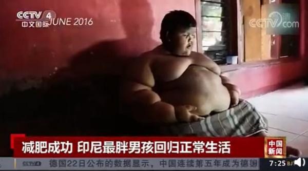世界最胖男孩减重200斤，前后变化有多大？别等脂肪来了再行动