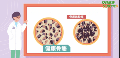  守护骨骼健康 乐骨行动2021在路上