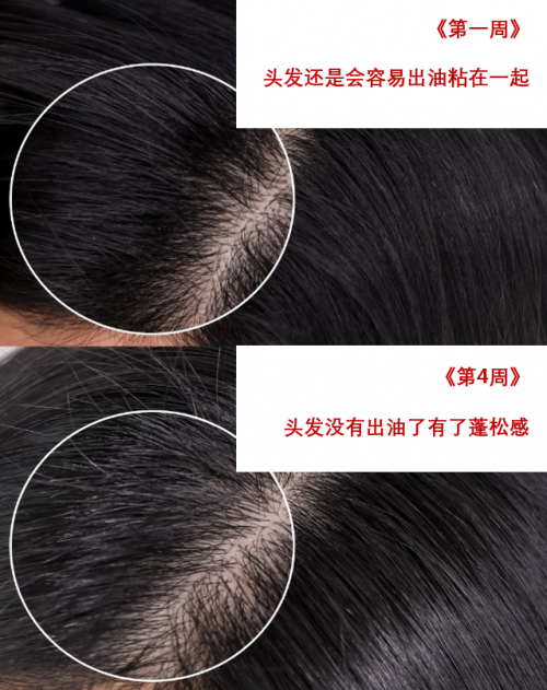 drforhair洗发水怎么样？旗下海盐磨砂膏改善头皮环境去屑又止痒