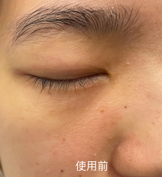 唯品会热销面膜评测：功能型面膜VS补水面膜，你选对了吗？