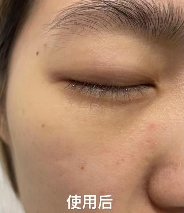 唯品会热销面膜评测：功能型面膜VS补水面膜，你选对了吗？