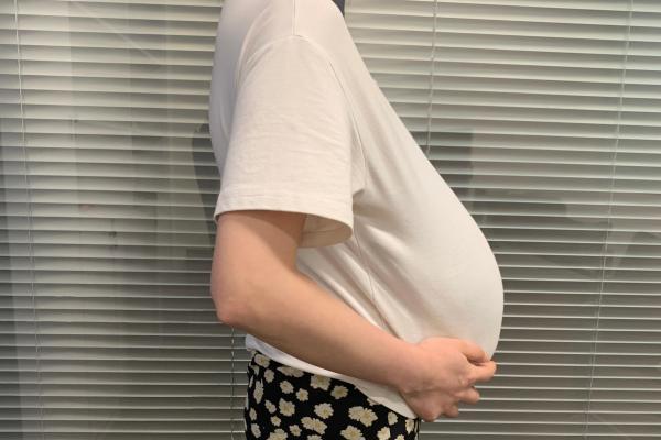 孕妇肚子上有条线是怎么回事