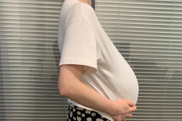 女性意外怀孕的早期症状有哪些