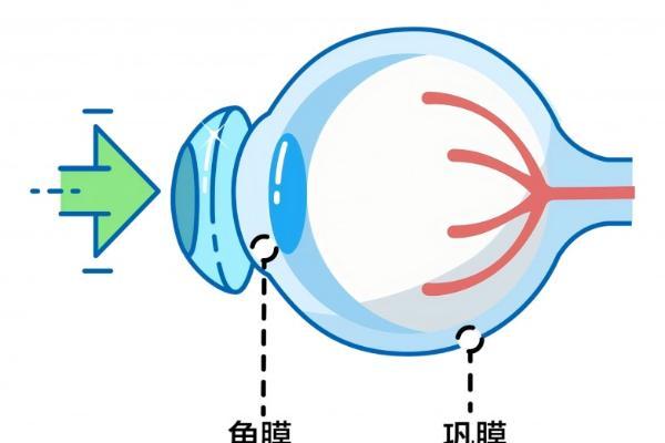 在河池，如何为孩子近视配OK镜（角膜）筛选专业医疗机构？