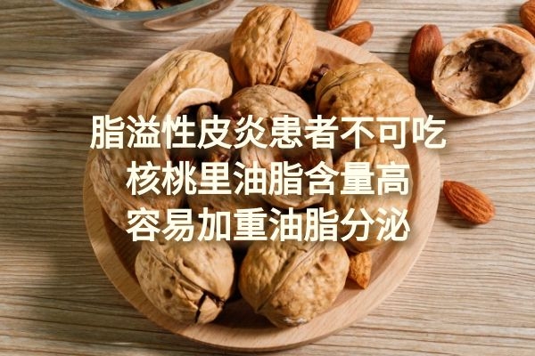 脂溢性皮炎患者