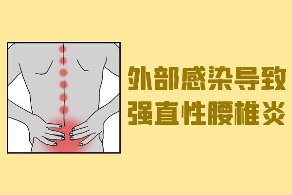 外部感染