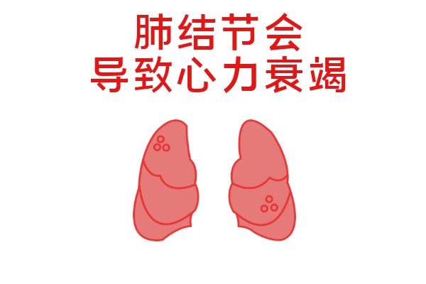 心力衰竭