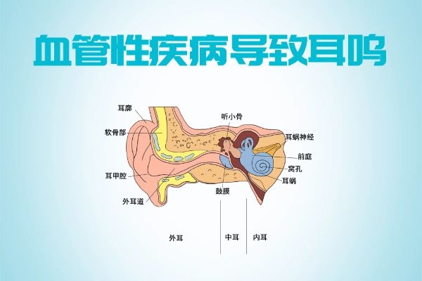 血管性疾病