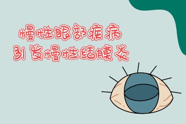 慢性眼部疾病