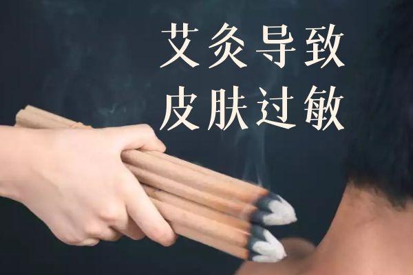 艾灸有哪些副作用？常见的有以下3种