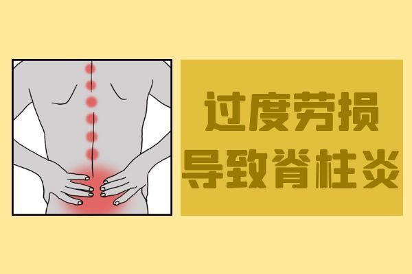 脊柱炎是怎么引起的 脊柱炎的原因