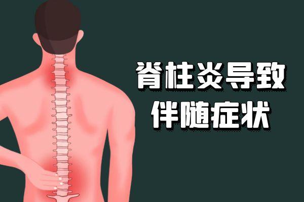 脊柱炎的症状 脊柱炎有什么表现