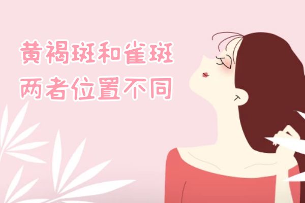 位置不同