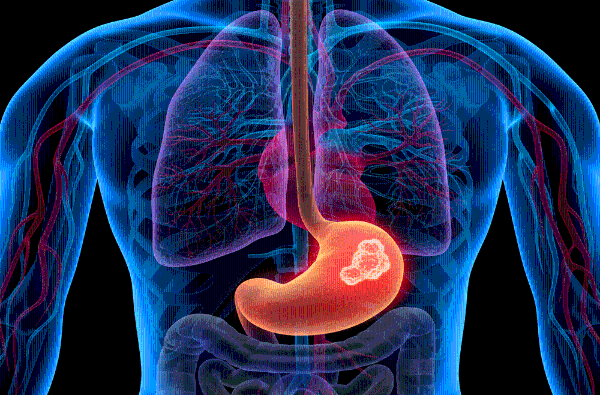 医疗AI智能体进化论：华为AI数据平台助力华西睿宾2完成质变