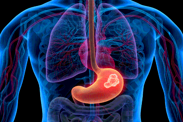 ​医疗AI智能体进化论：华为AI数据平台助力华西睿宾2完成质变