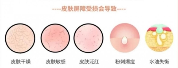 换季敏感干纹多？hfp悬金次抛精华伴你安稳过度