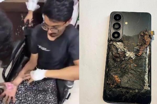 三星Galaxy手机在用户裤袋中爆炸：印度男子双手及下半身严重烧伤