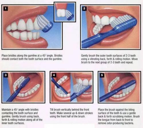  牙科治疗费用高？一晤未来自适应电动牙刷呵护口腔健康