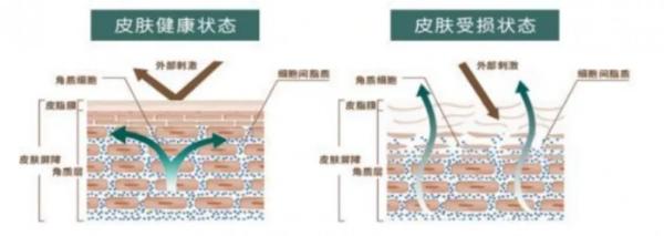  皮肤屏障受损怎么办？看看半亩花田的“修护大法”吧