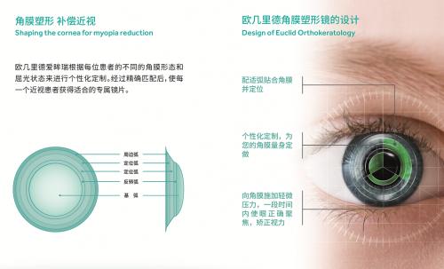  睡前戴上醒来摘下角膜塑形镜，白天他人就不知道你是近视眼，神奇！