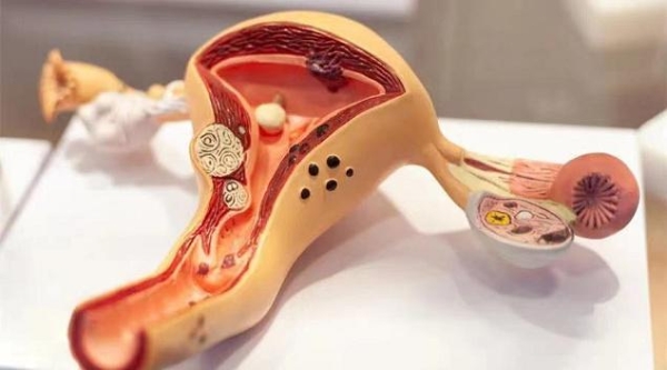  热搜第一！丁香医生科普：困扰女性的“宫颈糜烂”，到底算不算病？
