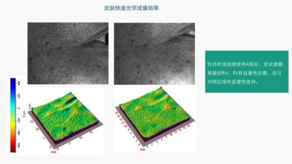 重磅首发！国内首份牡丹功效报告出炉，MCL花皙蔻领跑牡丹抗衰！