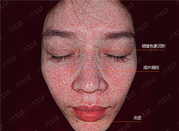  AI技术攻克测肤难题 美大招皮肤检测仪助美容院实现“一肤一方”