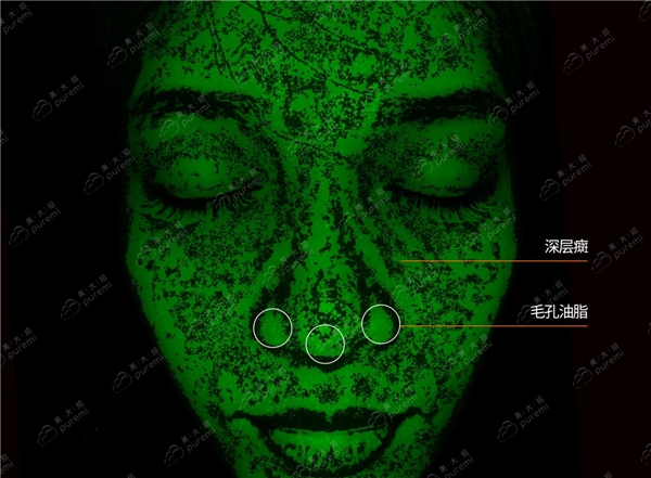  AI技术攻克测肤难题 美大招皮肤检测仪助美容院实现“一肤一方”