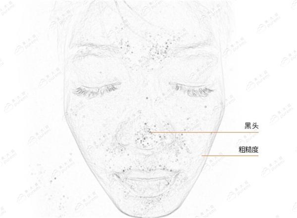  AI技术攻克测肤难题 美大招皮肤检测仪助美容院实现“一肤一方”