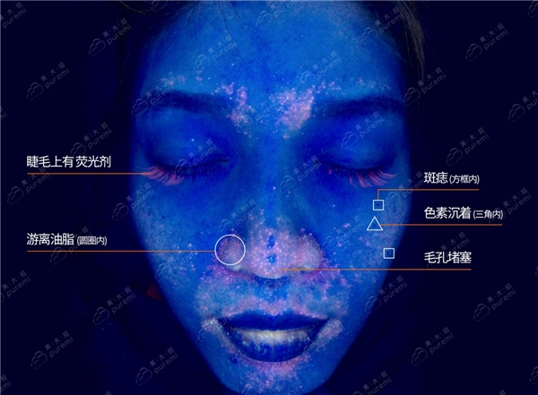  AI技术攻克测肤难题 美大招皮肤检测仪助美容院实现“一肤一方”