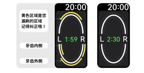 一晤未来|国民口腔问题刻不容缓，一晤未来智能手动牙刷呵护国民口腔健康