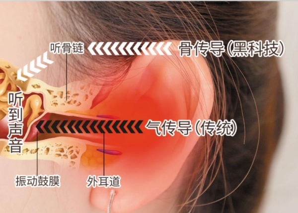 爱耳日｜如何正确爱护你的耳朵 选一款好用的骨传导耳机