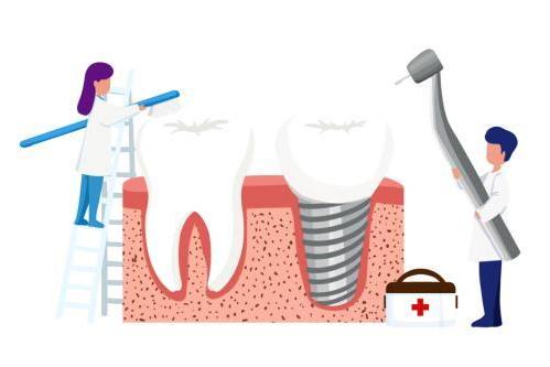 二十余年专注种植牙术后护理 钛舒美捍卫患者牙周健康