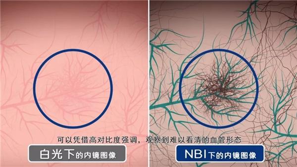 第十三届中国医疗设备行业数据发布大会召开 奥林巴斯连续13年斩获佳绩