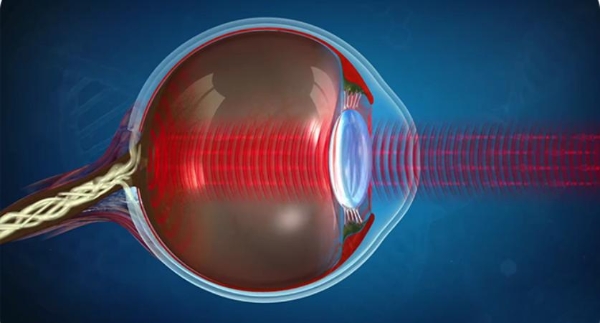  Foodmagic：国人自主研发的红光视力改善产品