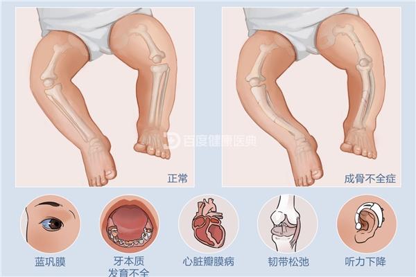 轮椅上的玻璃男孩李帅 逆袭成中国版钢铁侠