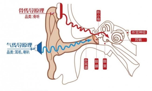 开放式？骨传导？难受的是身体还是听力？