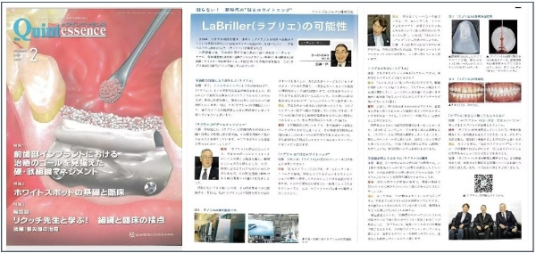  日本专家深度解读：LaBriller皓昕极薄贴面如何引领美齿新潮流，实现科技与美学的融合