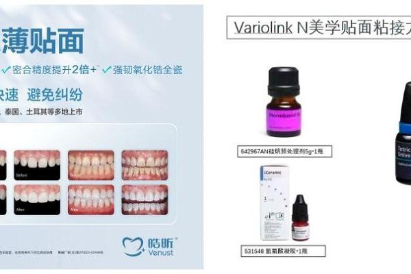 皓昕与义获嘉合作推动极薄贴面修复技术，让“微笑重塑”精准升级 
