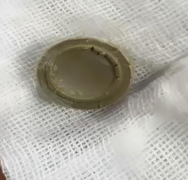 11岁猫咪的生命接力：新瑞鹏旗下宠颐生宠物医院沈阳中心医院的救援实录 