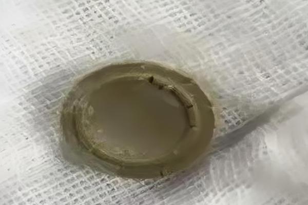 11岁猫咪的生命接力：新瑞鹏旗下宠颐生宠物医院沈阳中心医院的救援实录 