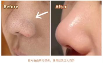 消费者测评 | 换季护肤大作战，hfp果酸精粹水效果怎么样？ 