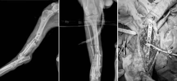 瑞派明星专科：重塑筋骨，守护生命的每一份支撑 