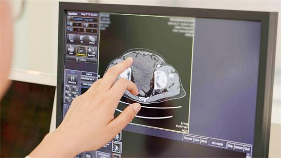 一张影像六市共享，一份报告六市互认，大连中山推动医疗同质化 