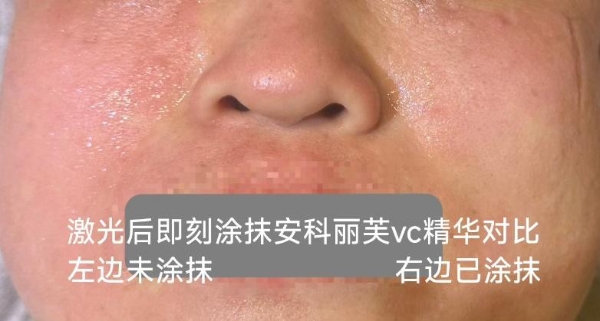 安科丽&安科丽芙品牌以专业力量驱动功效护肤进阶，共绘皮肤科发展新蓝图 