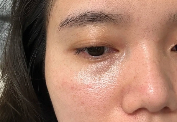 秋冬美肤指南 | hfp果酸精粹水让肌肤细腻丝滑入冬 