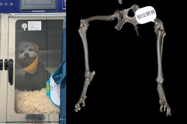 瑞派明星专科：重塑筋骨，守护生命的每一份支撑 