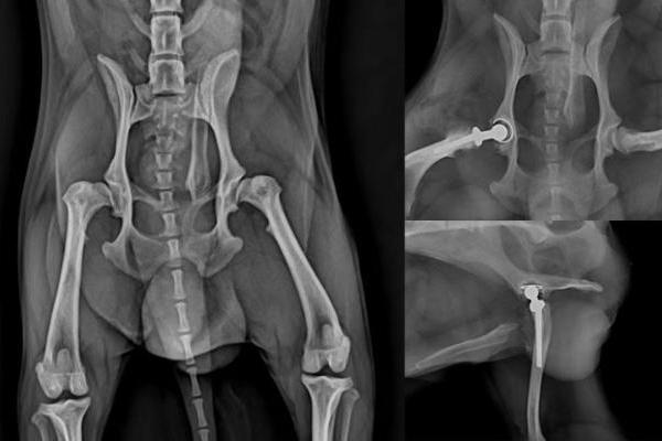 瑞派明星专科：重塑筋骨，守护生命的每一份支撑 